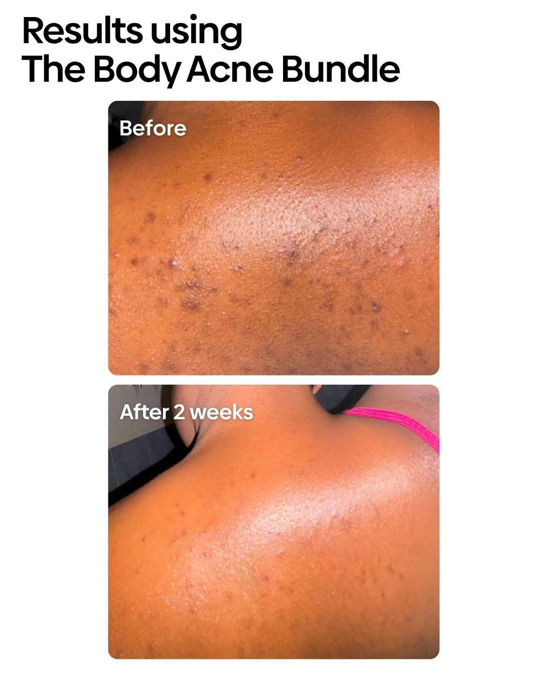 Bumps Be Gone