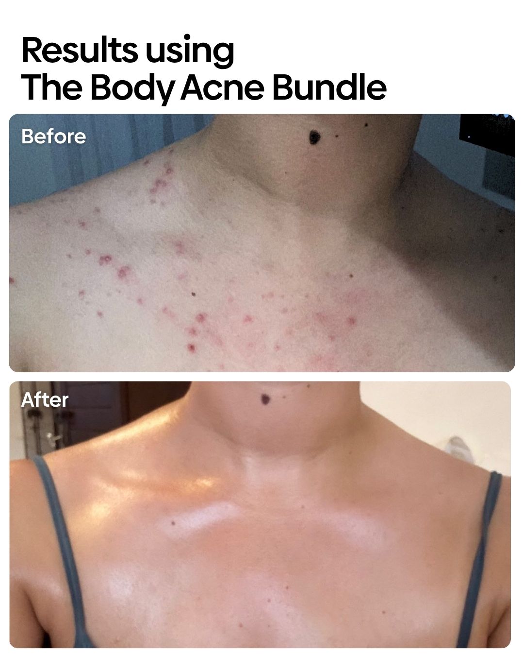 Bumps Be Gone