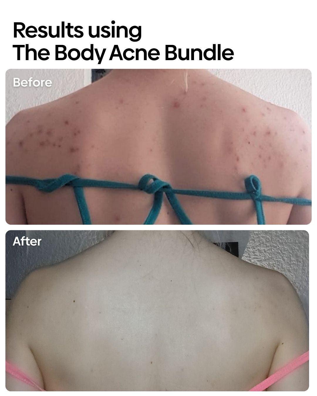 Bumps Be Gone