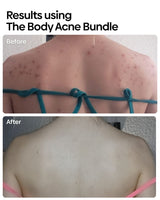 Bumps Be Gone